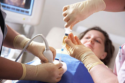 Амниоцентез – проверка околоплодных вод