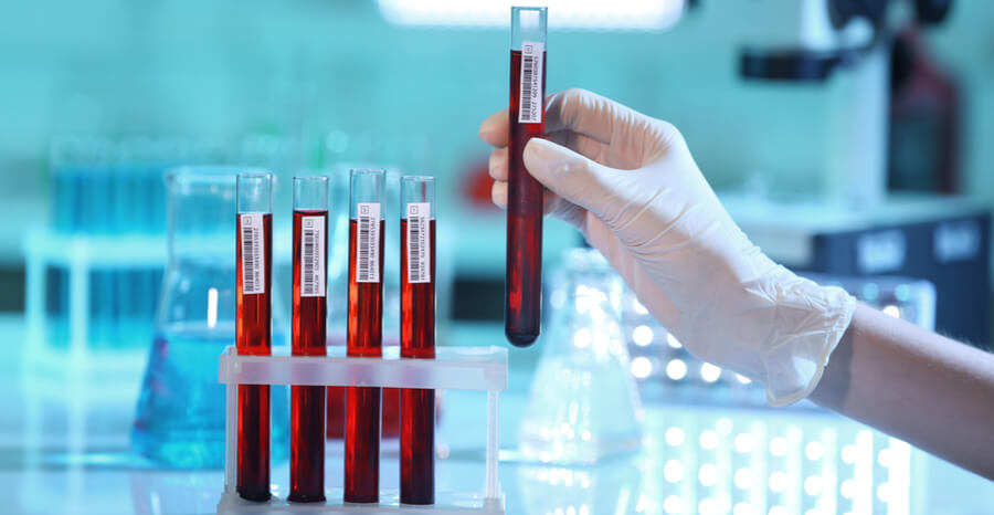 Анализ крови на гормоны