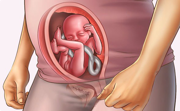 Истмико-цервикальная недостаточность (ИЦН)